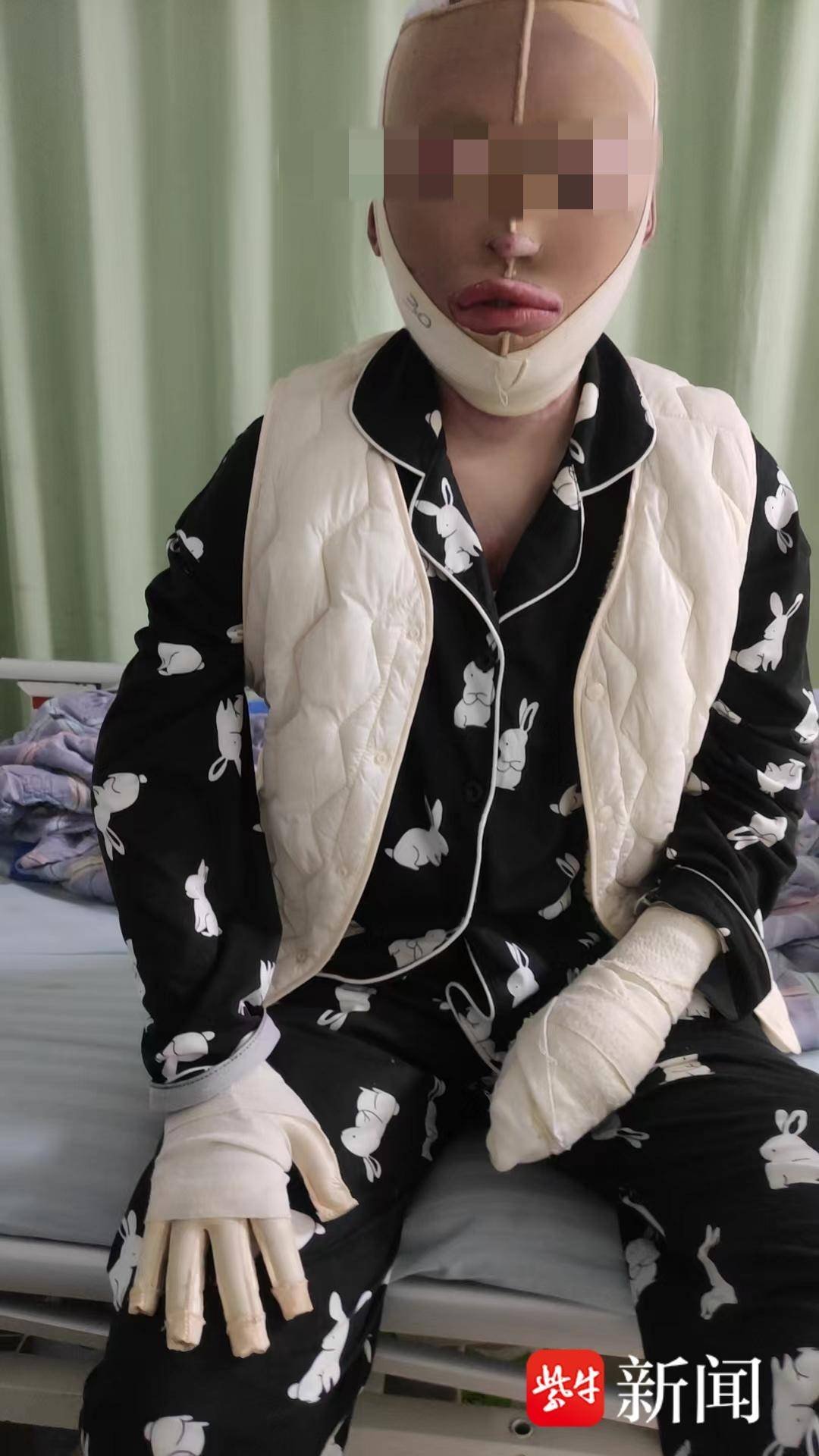 紫牛热点|“女子被前男友泼汽油致残毁容”案一审宣判,男方犯故意杀人罪被判12年