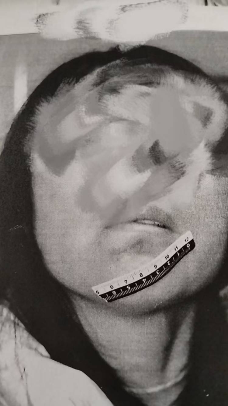 男粉丝咬伤女主播后写条子：赔“十万元”还是赔“十5元”？