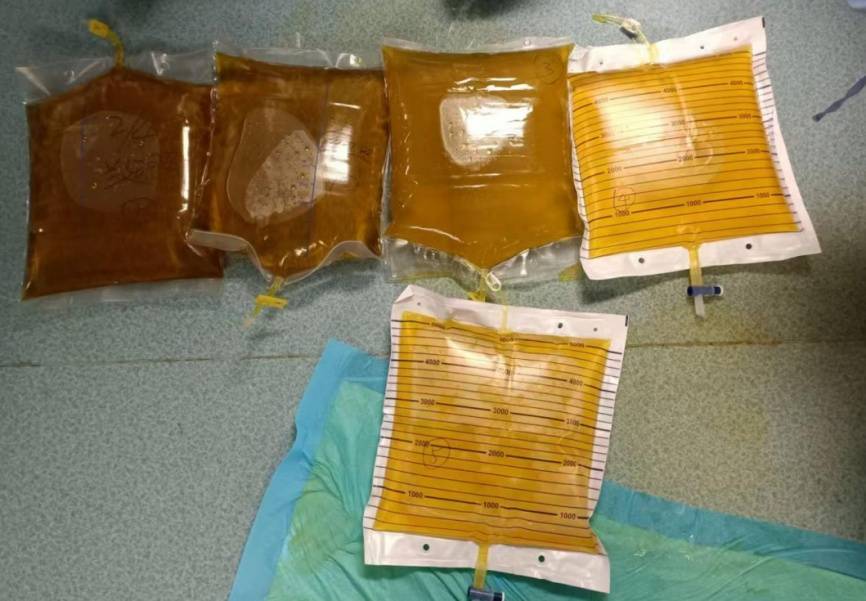 一锅下肚，广东一男子病危休克！死亡率接近100%，再次提醒：不采，不吃