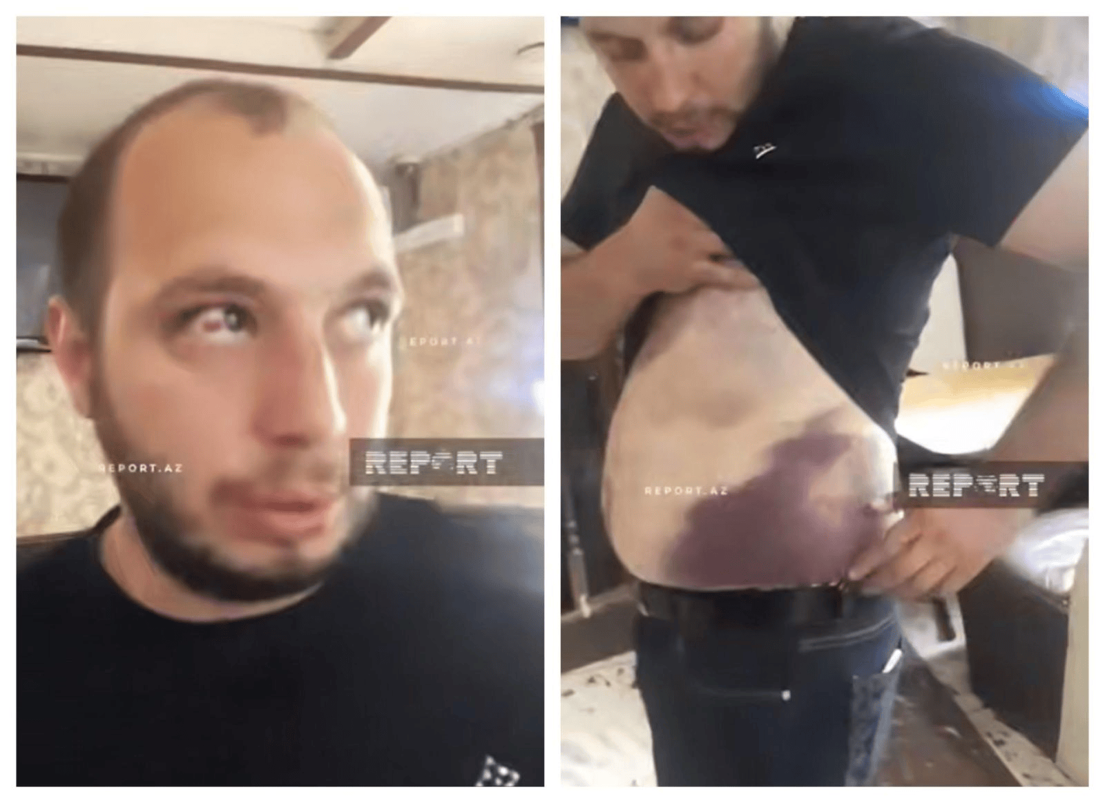 阿塞拜疆公民疑遭俄执法人员殴打身亡 两国关系急剧恶化