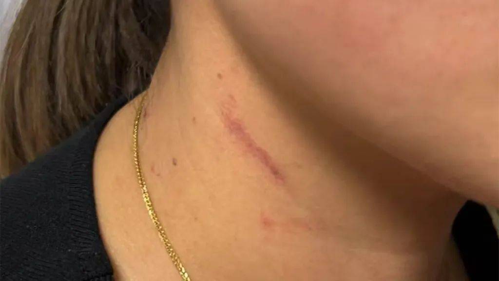 云南一男子酒后逼问妻子“是否出轨”并施暴，被警方行拘4日